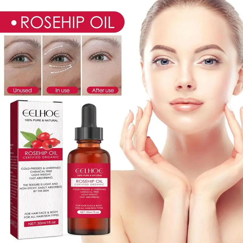 Huile de graines de rose musqu - Cold Pressed Rose Hip avis et prix